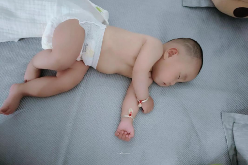 乐陵六个月宝宝眼睛散光